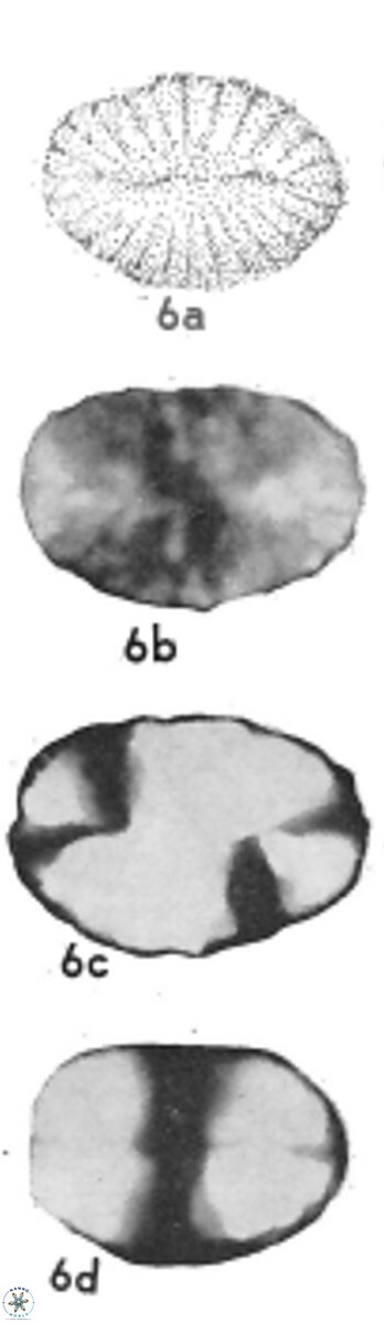 Pontosphaera ovata VR 32374