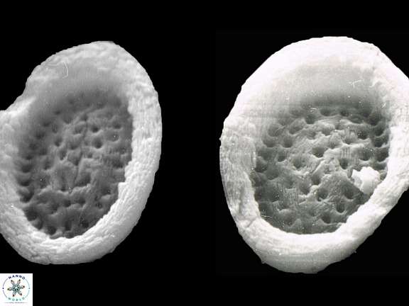 P apocresis