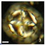 Prediscosphaera desiderograndis 11967