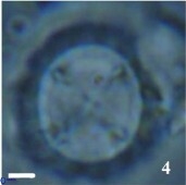 Prediscosphaera desiderograndis 11967
