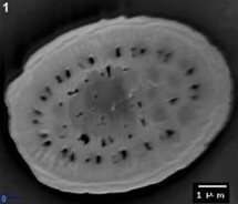 Pontosphaera geminiporus1 1177 2