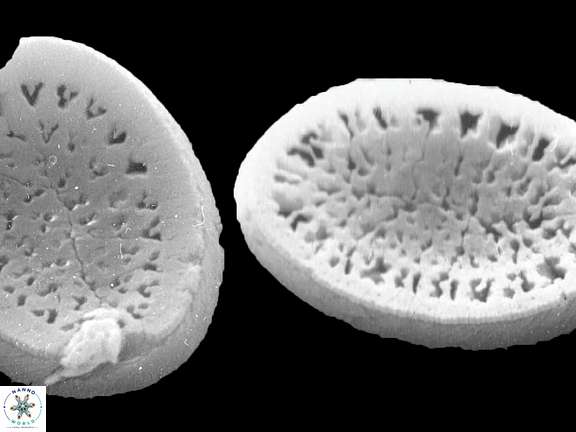 P geminipora 2