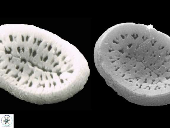 P geminipora