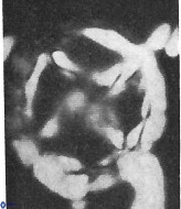 Prediscosphaera grandis 10126