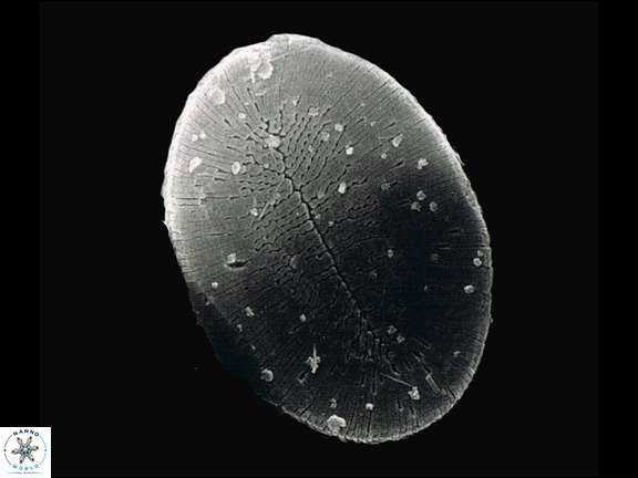 P japonica