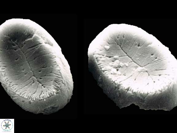 P scutellum