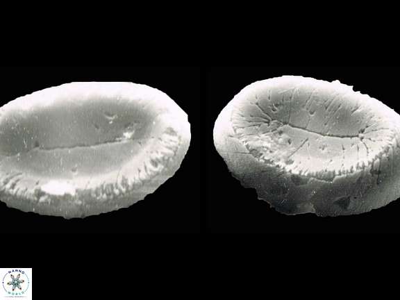 P scutellum 2