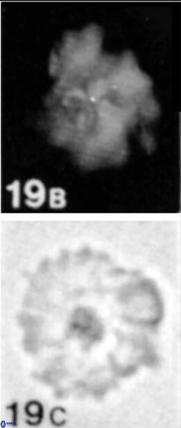 Pickelhaube umbellatum 11649