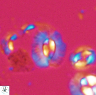 Palaeopontosphaera panis 21730