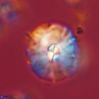 Palaeopontosphaera harrisonii 56473