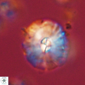 Palaeopontosphaera harrisonii 56473