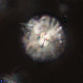 Palaeopontosphaera harrisonii 56475