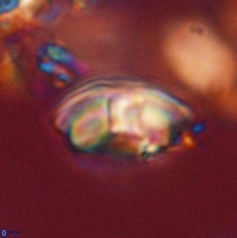 Palaeopontosphaera harrisonii 56481