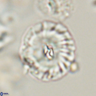 Palaeopontosphaera harrisonii 56492