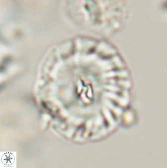 Palaeopontosphaera harrisonii 56492