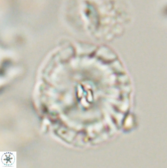 Palaeopontosphaera harrisonii 56493