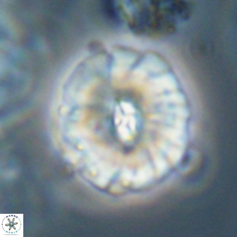 Palaeopontosphaera harrisonii 56496