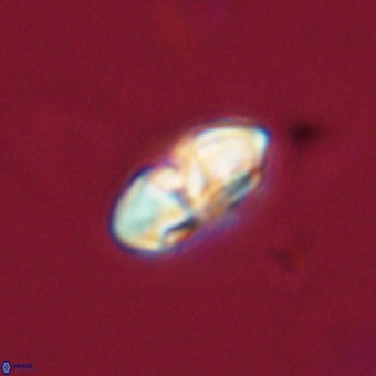 Palaeopontosphaera harrisonii 68028
