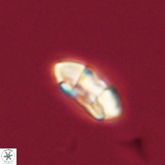 Palaeopontosphaera harrisonii 68032