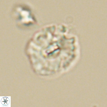 Palaeopontosphaera harrisonii 68039