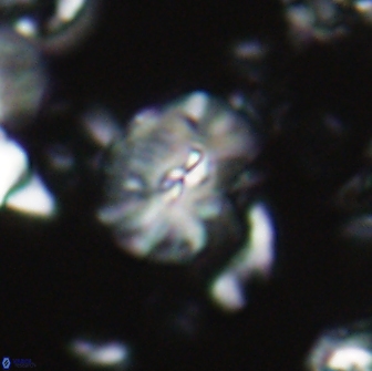 Palaeopontosphaera harrisonii 21693