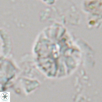 Palaeopontosphaera harrisonii 21698