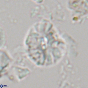 Palaeopontosphaera harrisonii 21699