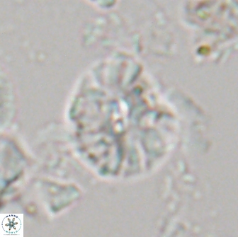 Palaeopontosphaera harrisonii 21699