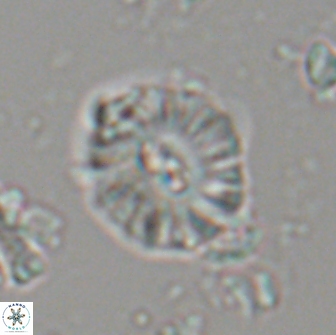 Palaeopontosphaera harrisonii 21725