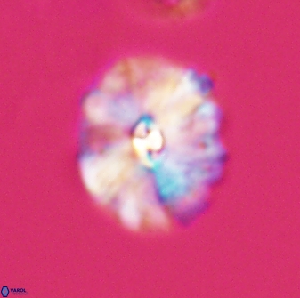 Palaeopontosphaera harrisonii 22897