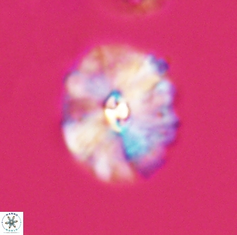Palaeopontosphaera harrisonii 22897