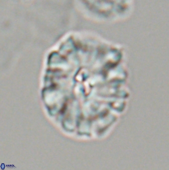 Palaeopontosphaera harrisonii 22901