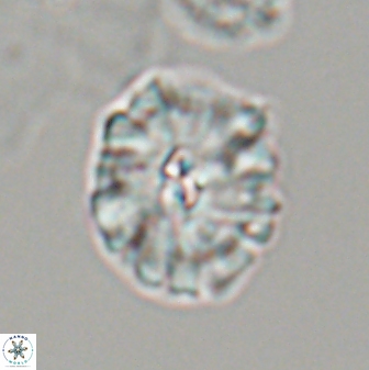 Palaeopontosphaera harrisonii 22901