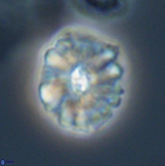 Palaeopontosphaera harrisonii 22902