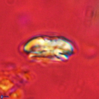 Palaeopontosphaera harrisonii VR 01144