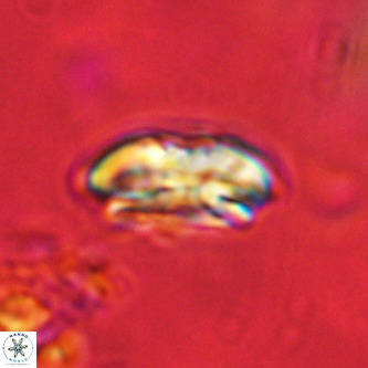 Palaeopontosphaera harrisonii VR 01144