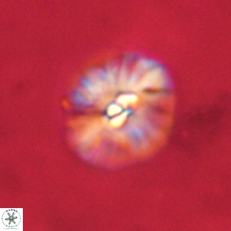 Palaeopontosphaera harrisonii VR 01100