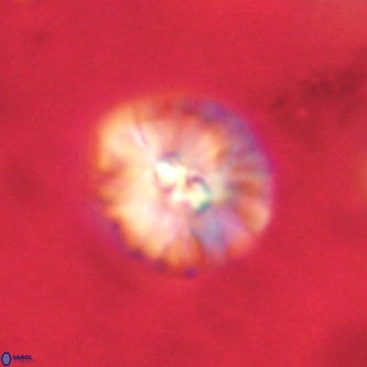 Palaeopontosphaera harrisonii VR 01104