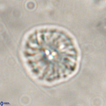 Palaeopontosphaera harrisonii VR 01105