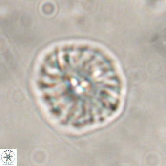 Palaeopontosphaera harrisonii VR 01105