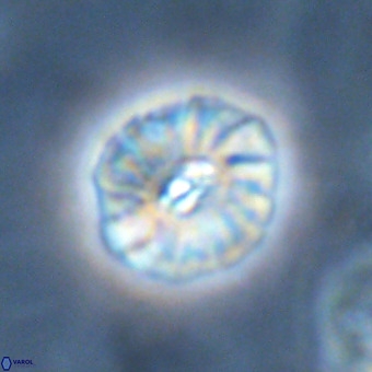 Palaeopontosphaera harrisonii VR 01110