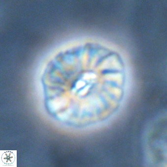 Palaeopontosphaera harrisonii VR 01110
