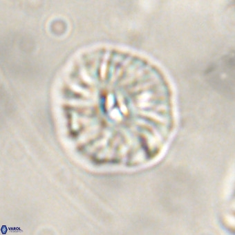 Palaeopontosphaera harrisonii VR 01113