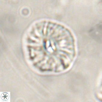 Palaeopontosphaera harrisonii VR 01113