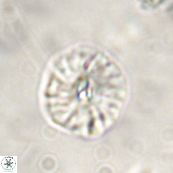 Palaeopontosphaera harrisonii VR 01114