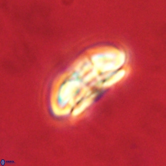 Palaeopontosphaera harrisonii VR 01119