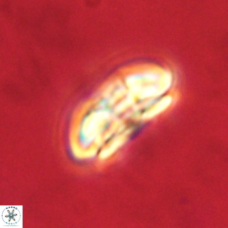 Palaeopontosphaera harrisonii VR 01119