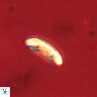 Palaeopontosphaera panis VR 00871