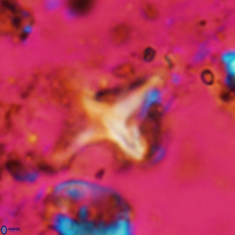 Palaeorhomboaster svabenickae 580