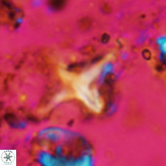 Palaeorhomboaster svabenickae 580